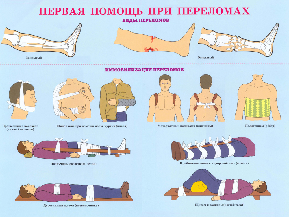 Первая помощь при переломах.jpg